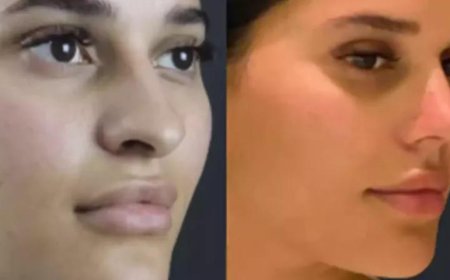 Rhinoplasty in Dubai: What You Need to Know About Scars
