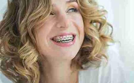 Thoughtful Orthodontics for Growing Smiles in Gosport
