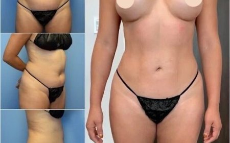 Find Your Perfect Shape with the Best Body Contouring Surgeon in Dubai