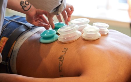 Cupping Therapy in Philly: Ancient Healing, Modern Twist