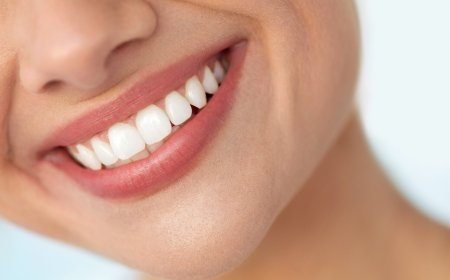 What You Need to Know About Getting a Tooth Crown in Dubai