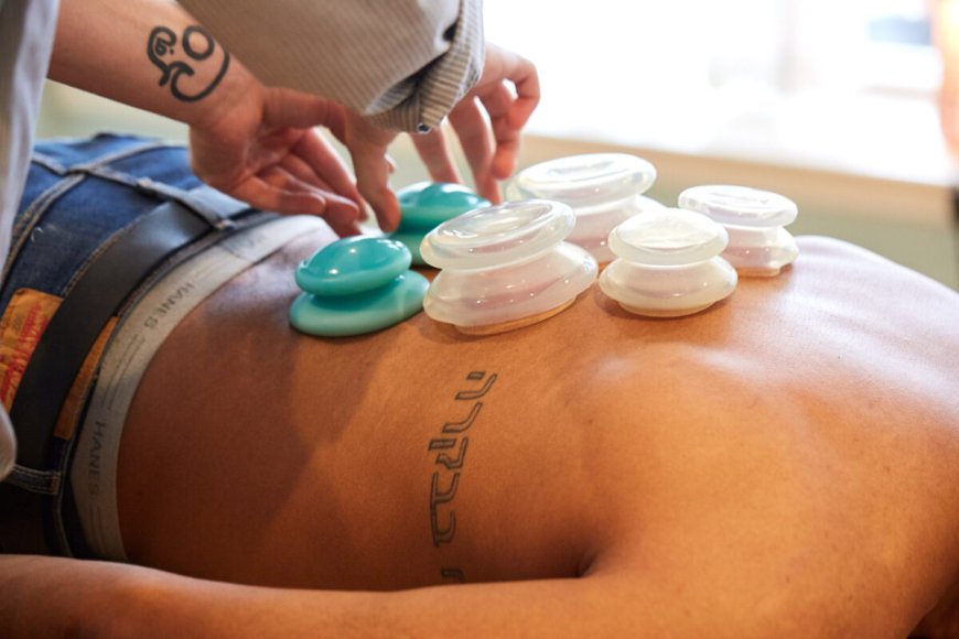Cupping Therapy in Philly: Ancient Healing, Modern Twist